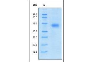 SDS-PAGE (SDS) image for VEGF Receptor 2 (VEGFR2) (AA 20-764) (Active) protein (His tag) (ABIN6253722) (VEGFR2/CD309 Protein (AA 20-764) (His tag))