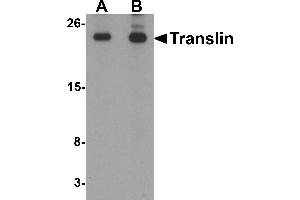 Western blot analysis of Translin in rat lung tissue lysate with Translin antibody at (A) 0. (Translin antibody  (C-Term))
