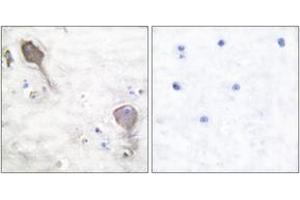 Immunohistochemistry analysis of paraffin-embedded human brain tissue, using Parkin Antibody. (Parkin antibody  (AA 1-50))