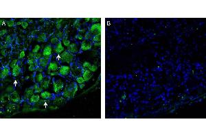 Expression of LAT1/SLC7A5 in rat dorsal root ganglion. (SLC7A5 antibody  (AA 222-235))