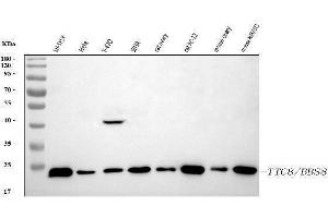 Western blot analysis of BBS8/TTC8 using anti-BBS8/TTC8 antibody (ABIN7601040).