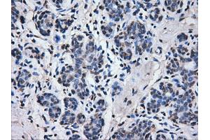 Immunohistochemical staining of paraffin-embedded breast tissue using anti-ATP5B mouse monoclonal antibody.