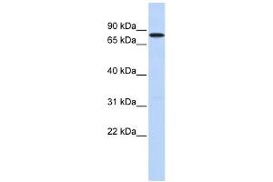 WB Suggested Anti-DDX41 Antibody Titration:  0. (DDX41 antibody  (N-Term))