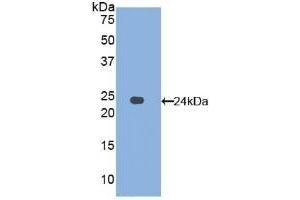 Detection of Recombinant AFM, Human using Polyclonal Antibody to Afamin (AFM) (Afamin antibody  (AA 211-403))