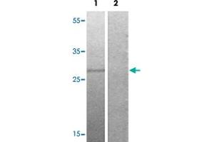 Western blot analysis of Lane 1: serum treated HepG2 cells, Lane 2: antigen-specific peptide treated HepG2 cells with OXSR1 (phospho T185) polyclonal antibody  at 1:500-1000 dilution. (OXSR1 antibody  (pThr185))