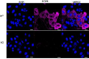 Immunocytochemical staining of HepG2 cells using EGFR antibody (ABIN7798480), 1:1,000), Top panel: wild-type (WT), Bottom panal: Adiponectin receptor 1 shRNA knockdown (KD). (Recombinant EGFR antibody)