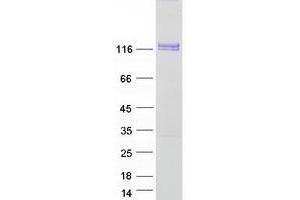 Western Blotting (WB) image for Discoidin Domain Receptor tyrosine Kinase 2 (DDR2) (Transcript Variant 1) protein (Myc-DYKDDDDK Tag) (ABIN2713456)