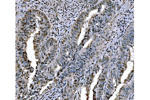 IHC analysis of Histone H1. (Histone H1 antibody  (AA 20-159))