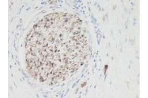 Image no. 1 for anti-Galectin 3 (LGALS3) antibody (ABIN464873) (Galectin 3 antibody)