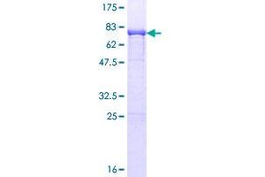 UAP1 Protein (AA 1-505) (GST tag)