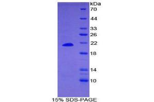 SDS-PAGE (SDS) image for Dermatopontin (DPT) (AA 26-197) protein (His tag) (ABIN1170316)