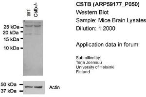 Western Blotting (WB) image for anti-Cystatin B (Stefin B) (CSTB) (N-Term) antibody (ABIN2787965) (CSTB antibody  (N-Term))