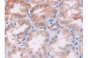 Immunohistochemistry (IHC) image for anti-Phosphoinositide-3-Kinase, Catalytic, beta Polypeptide (PIK3CB) (AA 321-507) antibody (ABIN7438307)