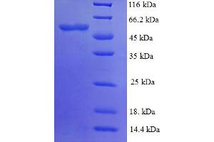 PYDC1 Protein (AA 18-470) (His tag)