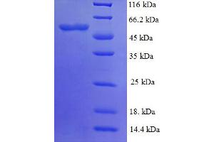 SDS-PAGE (SDS) image for PYD (Pyrin Domain) Containing 1 (PYDC1) (AA 18-470) protein (His tag) (ABIN4977076) (PYDC1 Protein (AA 18-470) (His tag))