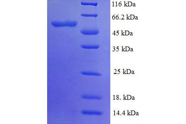 PYDC1 Protein (AA 18-470) (His tag)