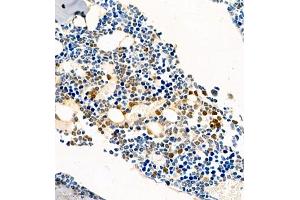 M-CSF/CSF1 antibody