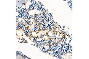 Immunohistochemistry of paraffin embedded mouse bone using CSF1 (ABIN7073553) at dilution of 1:450 (400x lens)