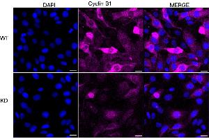 Immunocytochemical staining of HT cells using Cyclin B1 antibody (ABIN7798189), 1:1,000), Top panel: wild-type (WT), Bottom panal: Cyclin B1 shRNA knockdown (KD).
