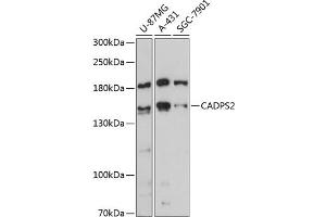 Western blot analysis of extracts of various cell lines, using C antibody (ABIN6131398, ABIN6137845, ABIN6137846 and ABIN6217950) at 1:3000 dilution.