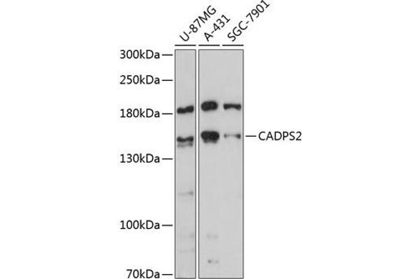 CADPS2 抗体  (AA 1-80)