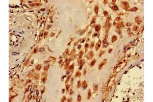 Immunohistochemistry of paraffin-embedded human placenta tissue using ABIN7163206 at dilution of 1:100 (PIGA antibody  (AA 443-484))
