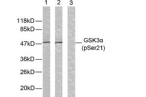 Western blot analysis of extracts from ovary cancer cells using GSK3α (phospho-Ser21) antibody (E011007). (GSK3 alpha antibody  (pSer21))