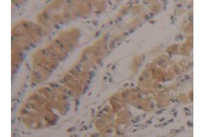 DAB staining on IHC-P; Samples: Human Stomach Tissue (SUOX antibody  (AA 80-545))