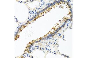 Immunohistochemistry of paraffin-embedded rat lung using CST4 antibody at dilution of 1:100 (40x lens). (CST4 antibody)