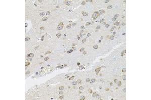 Immunohistochemistry of paraffin-embedded mouse brain using VEPH1 antibody. (VEPH1 antibody  (AA 448-547))