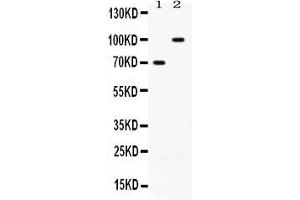 Western blot analysis of ZP1 expression in rat ovary extract ( Lane 1) and SKOV3 whole cell lysates ( Lane 2). (ZP1 antibody  (N-Term))