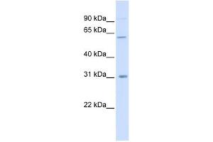 CHST2 antibody used at 1 ug/ml to detect target protein. (CHST2 antibody)