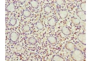 Immunohistochemistry of paraffin-embedded human colon tissue using ABIN7142431 at dilution of 1:100 (MRPL49 antibody  (AA 1-166))