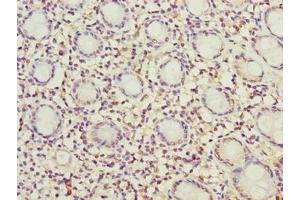 Immunohistochemistry of paraffin-embedded human colon tissue using ABIN7142431 at dilution of 1:100 (MRPL49 antibody  (AA 1-166))