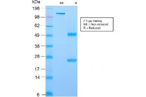 SDS-PAGE Analysis Purified YBX1 Mouse Recombinant Monoclonal Antibody (rYBX1/2430). (Recombinant YBX1 antibody)