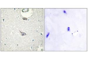 Immunohistochemistry analysis of paraffin-embedded human brain tissue using CADM4 antibody. (Cell Adhesion Molecule 4 antibody  (C-Term))
