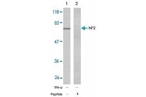 Western blot analysis of extracts from 293 cells untreated or treated with IFN-alpha (100 ng/mL, 15 min) using NF2 polyclonal antibody .