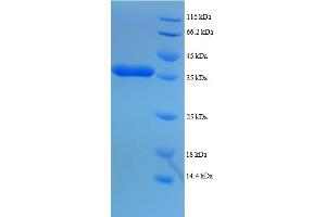 SDS-PAGE (SDS) image for Dynein, Light Chain, LC8-Type 1 (DYNLL1) (AA 1-89), (full length) protein (GST tag) (ABIN5712129)