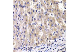 Immunohistochemistry of paraffin-embedded rat liver using RPL14 antibody at dilution of 1:100 (x400 lens).