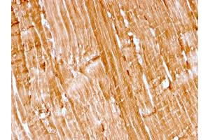 Formalin-fixed, paraffin-embedded human skeletal muscle stained with Myoglobin Recombinant Mouse Monoclonal Antibody (rMB/2105). (Recombinant Myoglobin antibody)