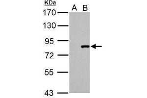 WB Image Cullin 3 antibody detects Cullin 3 protein by Western blot analysis.