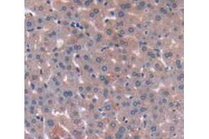Immunohistochemistry (IHC) image for anti-serpin Peptidase Inhibitor, Clade D (Heparin Cofactor), Member 1 (SERPIND1) (AA 256-342) antibody (ABIN1868333)