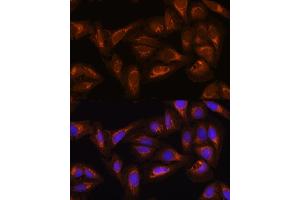Immunofluorescence analysis of U2OS cells using D Rabbit pAb (ABIN6127743, ABIN6139383, ABIN6139384 and ABIN6223348) at dilution of 1:100. (DAAM2 antibody  (AA 1-86))
