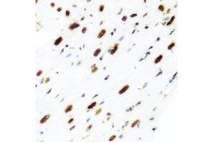 Immunohistochemistry of paraffin-embedded rat heart using H2AFX antibody (ABIN5997870) at dilution of 1/100 (40x lens). (H2AFX antibody)