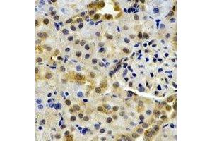 Immunohistochemical analysis of HPPDase staining in rat kidney formalin fixed paraffin embedded tissue section. (HPD antibody)