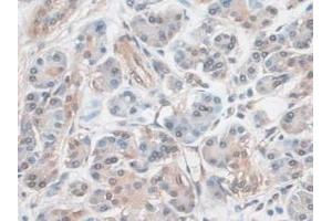 Detection of EZR in Human Pancreas Tissue using Polyclonal Antibody to Ezrin (EZR) (Ezrin antibody  (AA 1-295))