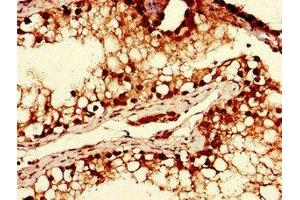 Immunohistochemistry of paraffin-embedded human testis tissue using ABIN7175942 at dilution of 1:100 (YTHDF2 antibody  (AA 201-500))