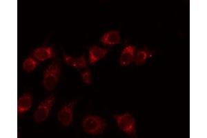 ABIN6275938 staining Hela by IF/ICC. (EMR3 antibody  (C-Term))
