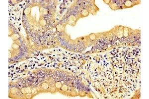 IHC image of ABIN7158430 diluted at 1:300 and staining in paraffin-embedded human small intestine tissue performed on a Leica BondTM system. (LPP antibody  (AA 227-391))