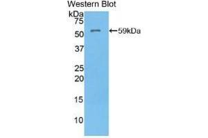 Detection of Recombinant ATP4a, Mouse using Polyclonal Antibody to ATPase, H+/K+ Exchanging Alpha Polypeptide (ATP4a) (ATP4A antibody  (AA 786-1014))